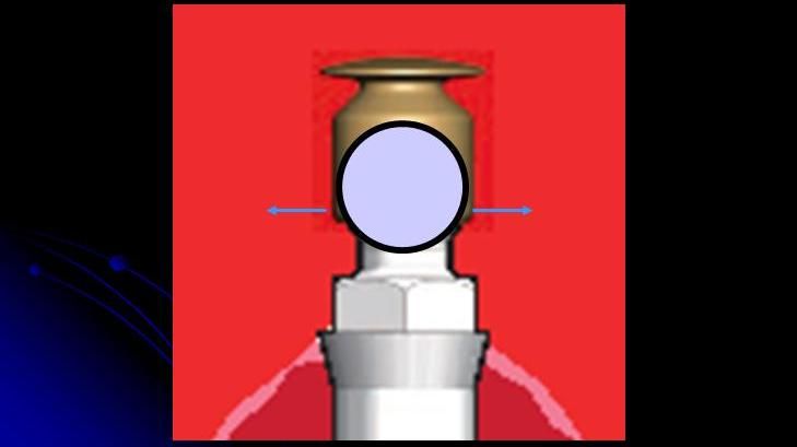 Implant (c) ngocson_tg_07 implant dentar