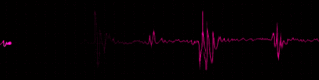 heartbeat photo: heartbeat heartbeat.gif